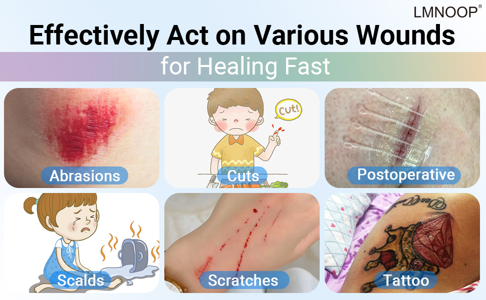 Pressure Sores Cream, Wound Healing Ointment Skin Repair Treatment Infection Protection First Aid Ointment for Pressure Sores