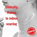 silverseal-burn-and-wound-dressing-hydro-5.jpg