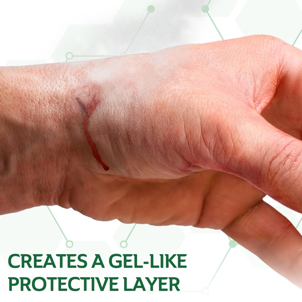 curad-quickstop-bleeding-control-spray-8-5.jpg