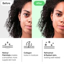 under-eye-patches-for-dark-circles-puffi-3.jpg