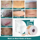 silicone-scar-sheets-1-6-x-158-roll-4m-m-6.jpg