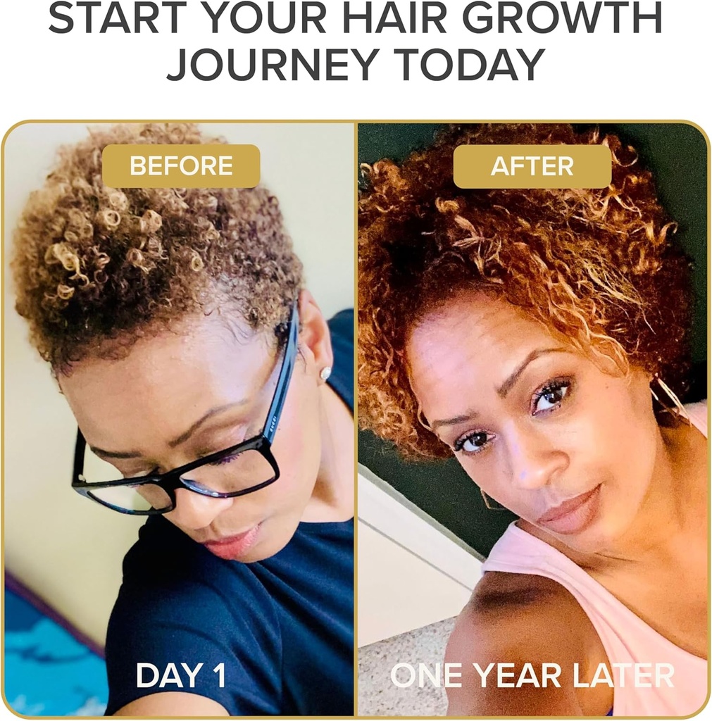 shedavi-iconic-natural-hair-vitamins-for-3.jpg
