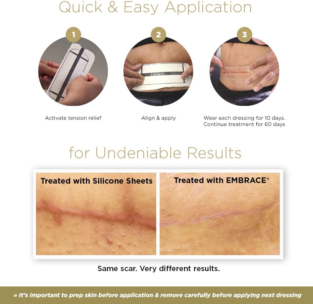 embrace-active-scar-defense-for-new-tumm-4.jpg