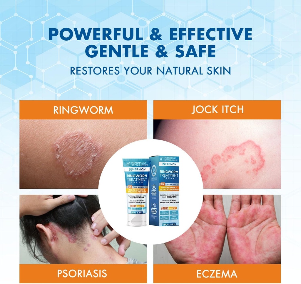 hermon-powerful-antifungal-ringworm-crea-3.jpg