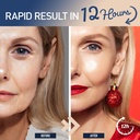enaskin-naturals-instant-anti-aging-eye--4.jpg