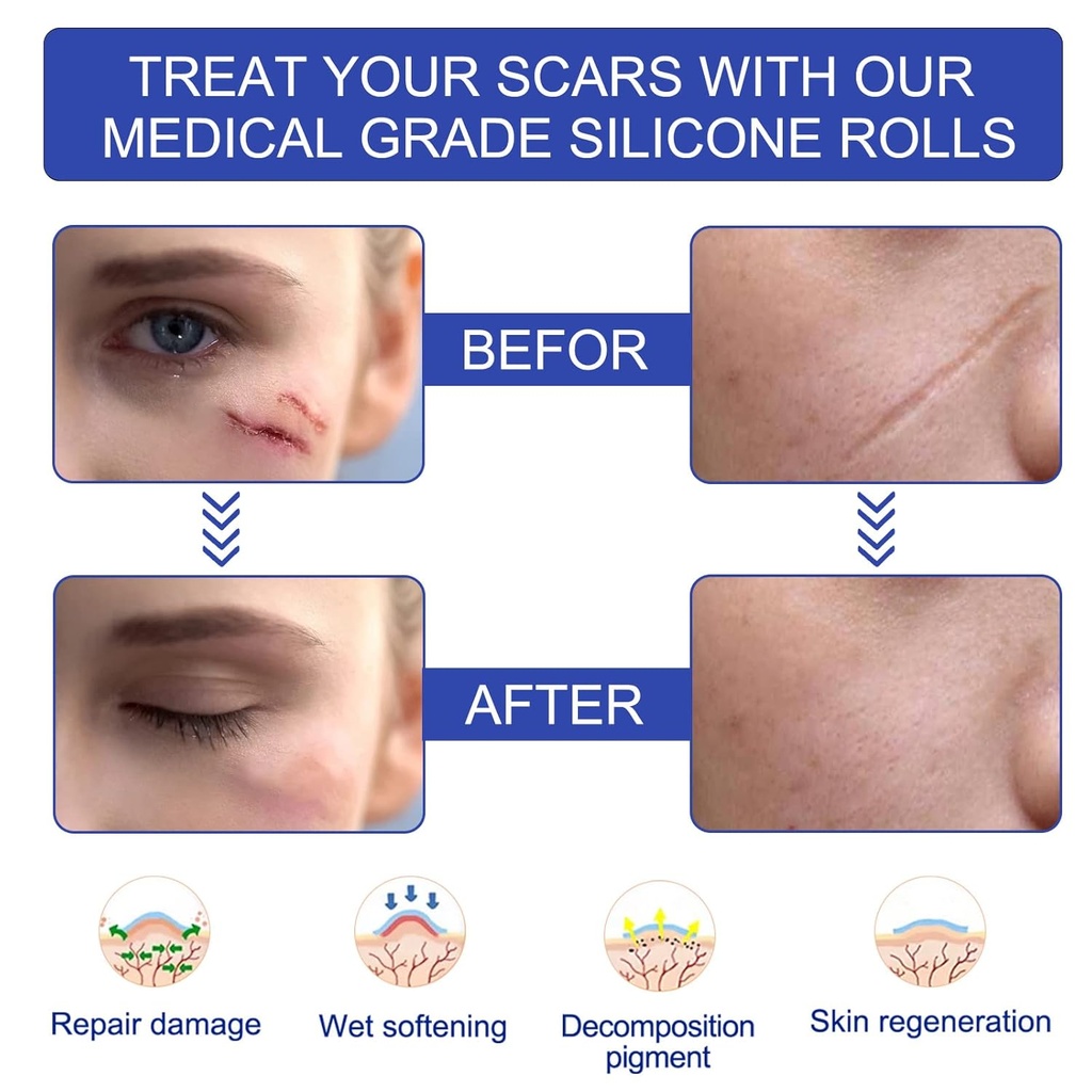 new-transparent-silicone-scar-sheets16-x-4.jpg