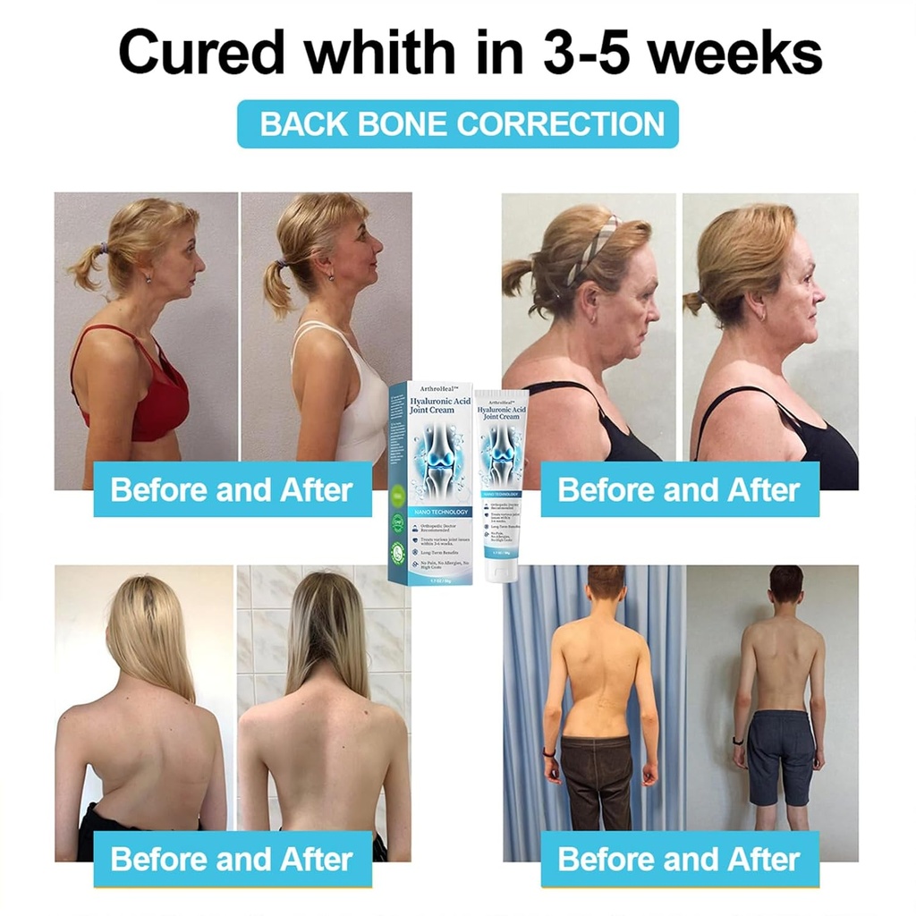 arthroheal-hyaluronic-acid-joint-r-epair-3.jpg