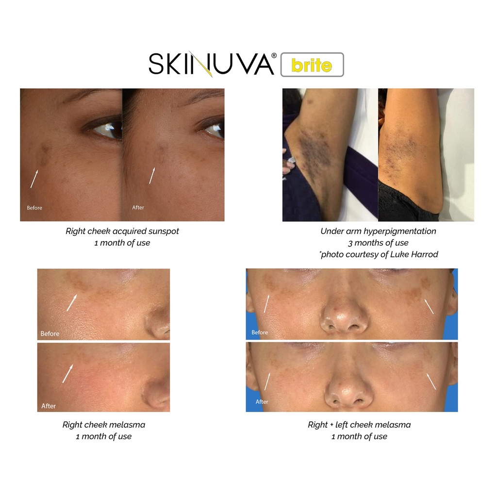 skinuva-complete-care-system-scar-spf-30-4.jpg