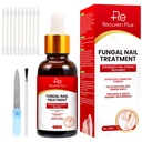 Tratamientos de hongos de uñas de pies para uñas: Tratamiento de hongos de uñas para uñas – Solución de fuerza extra, acción rápida para uñas agrietadas, dañadas, decoloradas