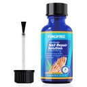 Tratamiento de hongos de uñas - Tratamiento de hongos de uñas para uñas - Tratamiento de hongos de uñas Tratamiento de hongos extra fuerza - Tratamiento de hongos de uñas (30ml)
