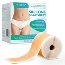 Sábanas de silicona, cinta de silicona, hojas de silicona para cicatrices, hojas de silicona de silicona para cara, acné, Keloid, bancos, marca de parche, eliminación de cicatrices quirúrgicas de detección de sección (1.6" x 60"Roll-1.5M)